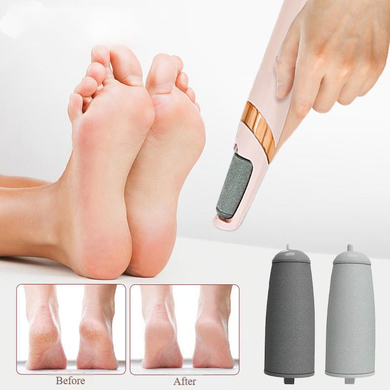 🔥 Final Sale – 69% off! Rechargeable Electric Callus Remover for baby-soft feet✨