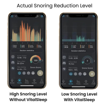 Yagoo™ Anti-Snoring Device
