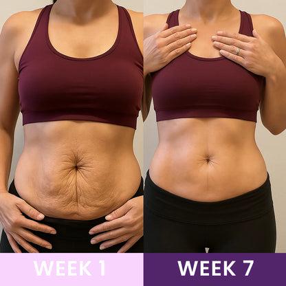 Yagoo™-Lose inches in weeks with waist trainer